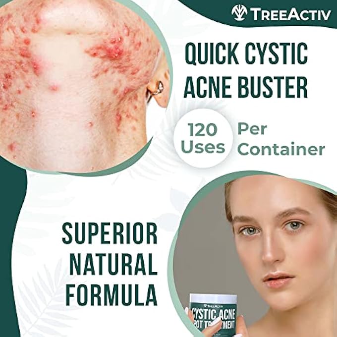 TreeActiv CYSTIC ACNE SPOT TREATMENT, 3% SULFUR BLEMISH REMOVER FOR MEN, WOMEN, TEENS & ADULTS, HORMONAL ACNE TREATMENT WITH ALOE VERA, BENTONITE, WITCH HAZEL & TEA TREE OIL FOR SKIN, 120+ TREATMENTS - Image 4
